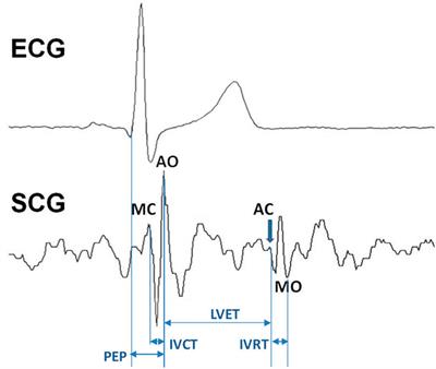 Can Seismocardiogram Fiducial Points Be Used for the Routine Estimation of Cardiac Time Intervals in Cardiac Patients?